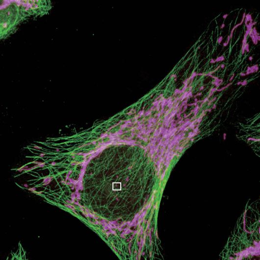 N-SIM Система высокого разрешения серии Super-Resolution