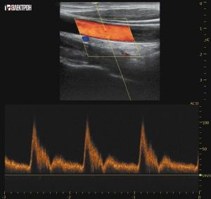 УЗИ Ультразвуковая система
