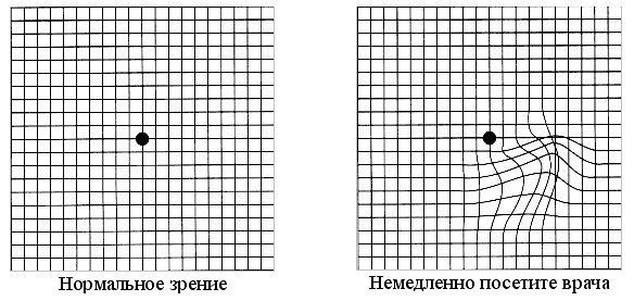 HDC - 9000 Проектор знаков для проверки зрения