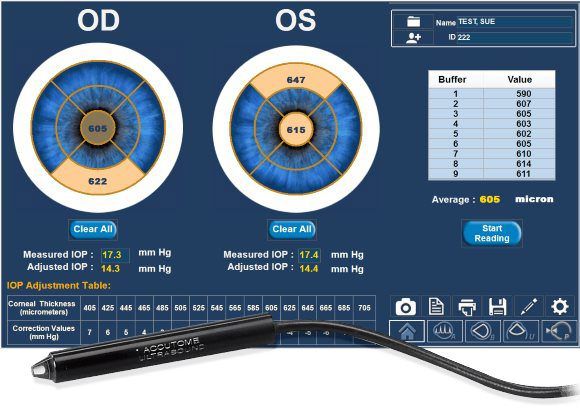 4Sight Офтальмологическая ультразвуковая система