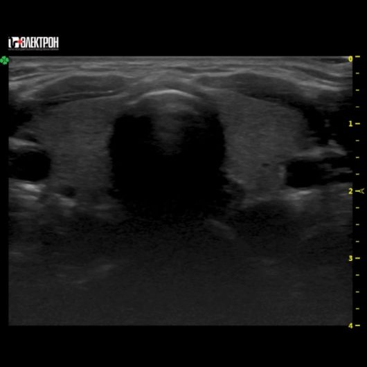 УЗИ Ультразвуковая система