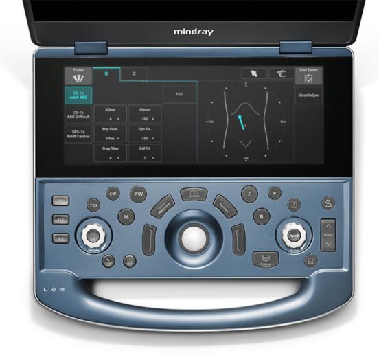 MX 8 Exp Портативная ультразвуковая система