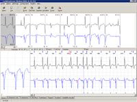 CARDIO DAY HOLTER Аппарат холтеровского мониторирования