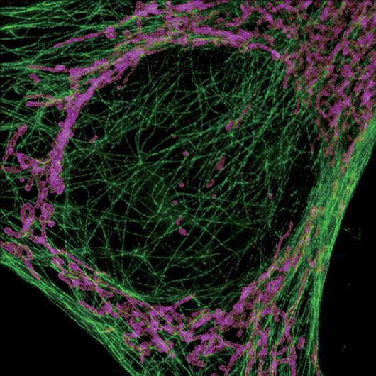 N-SIM Система высокого разрешения серии Super-Resolution