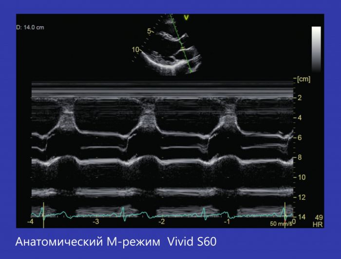 Vivid S60 Аппарат ультразвукового сканирования