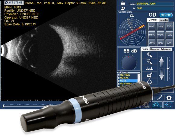 4Sight Офтальмологическая ультразвуковая система
