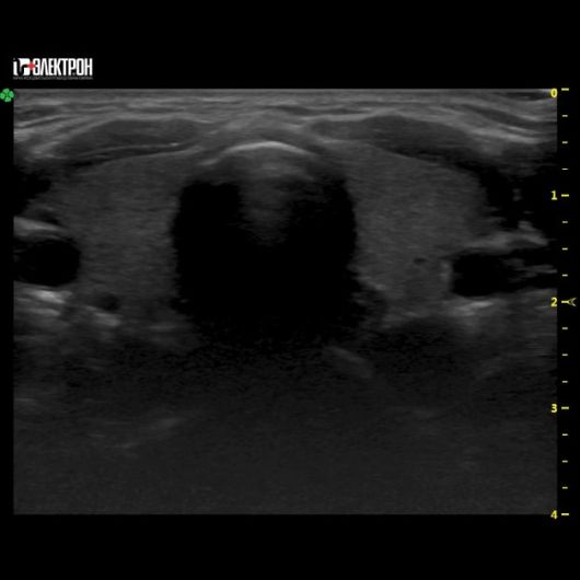 УЗИ Ультразвуковая система