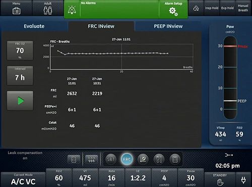 Carescape R860 Респираторная станция