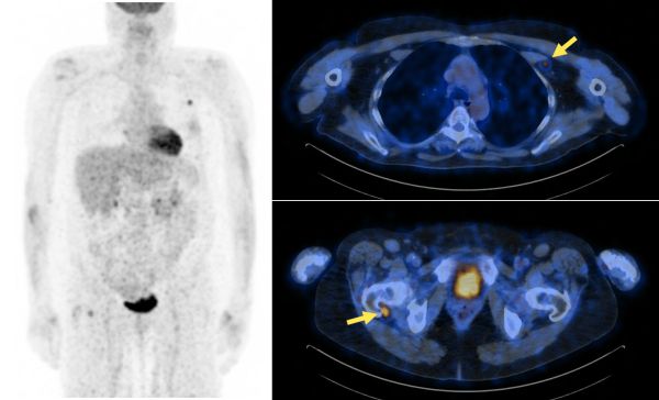 Vereos PET/CT Система ПЭТ/КТ