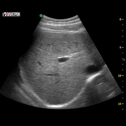 УЗИ Ультразвуковая система