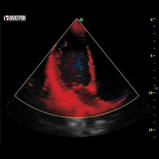 УЗИ Ультразвуковая система