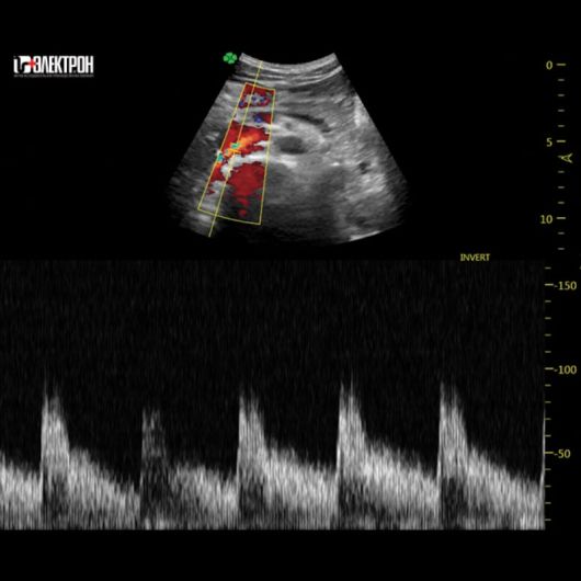 УЗИ Ультразвуковая система