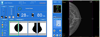 Маммограф для пленочной и цифровой рентгенографии молочной железы