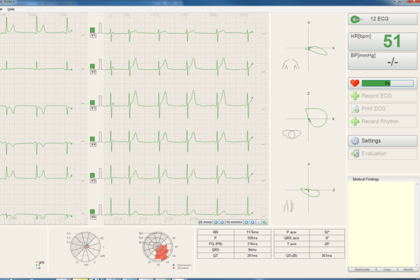 BTL CardioPoint Flexi Беспроводная стресс-тест система