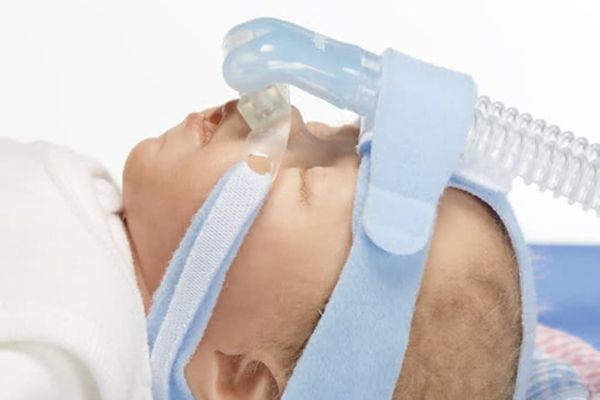 BabyFlow plus Назальный CPAP