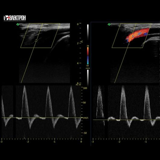 УЗИ Ультразвуковая система